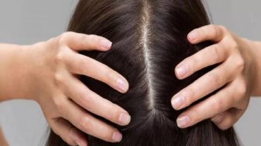 مؤشرات تنذر بوجود مشاكل في فروة الرأس