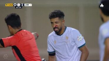 باهبري يتعرض لإصابة قوية ونزيف بالوجه خلال مواجهة الحزم.. فيديو