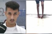فيصل الحازمي يعود للمشي بعد 17 عامًا من المعاناة مع القدم الحنفاء .. فيديو
