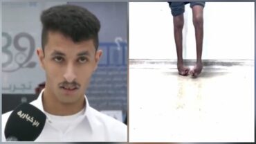 فيصل الحازمي يعود للمشي بعد 17 عامًا من المعاناة مع القدم الحنفاء .. فيديو
