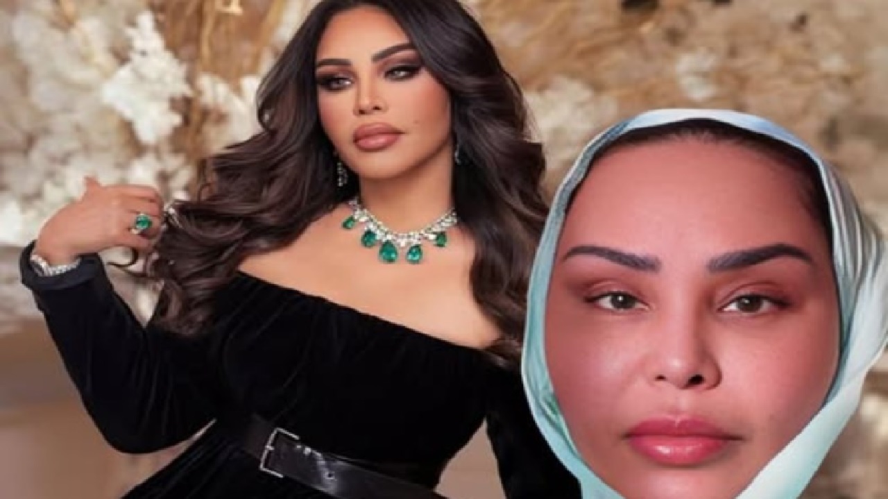 أحلام تظهر بالحجاب بعد خضوعها لشد الوجه ..صورة