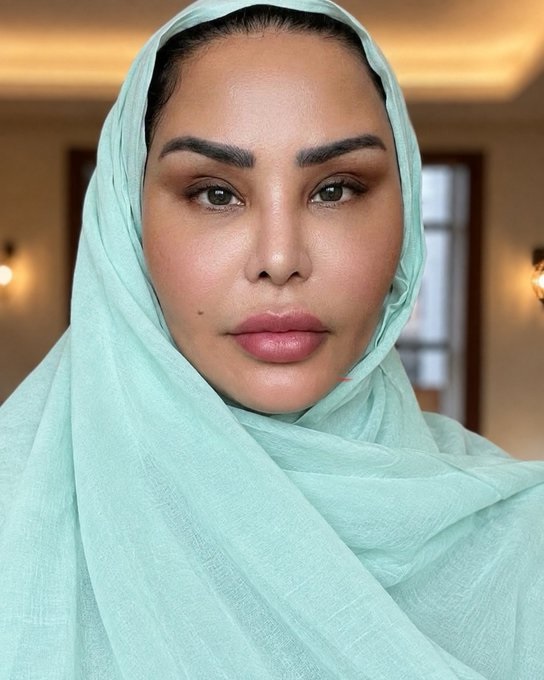 أحلام تظهر بالحجاب بعد خضوعها لشد الوجه ..صورة