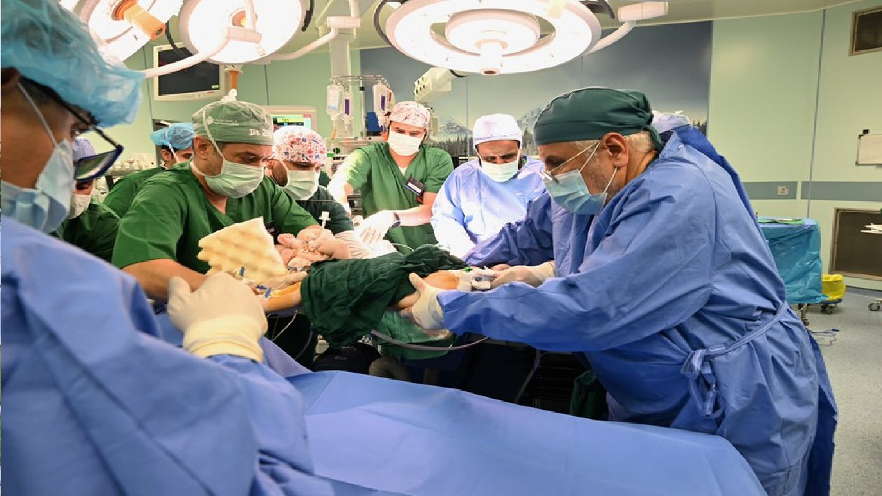 نجاح عملية فصل التوأم الملتصق المغربي سجى وضحى