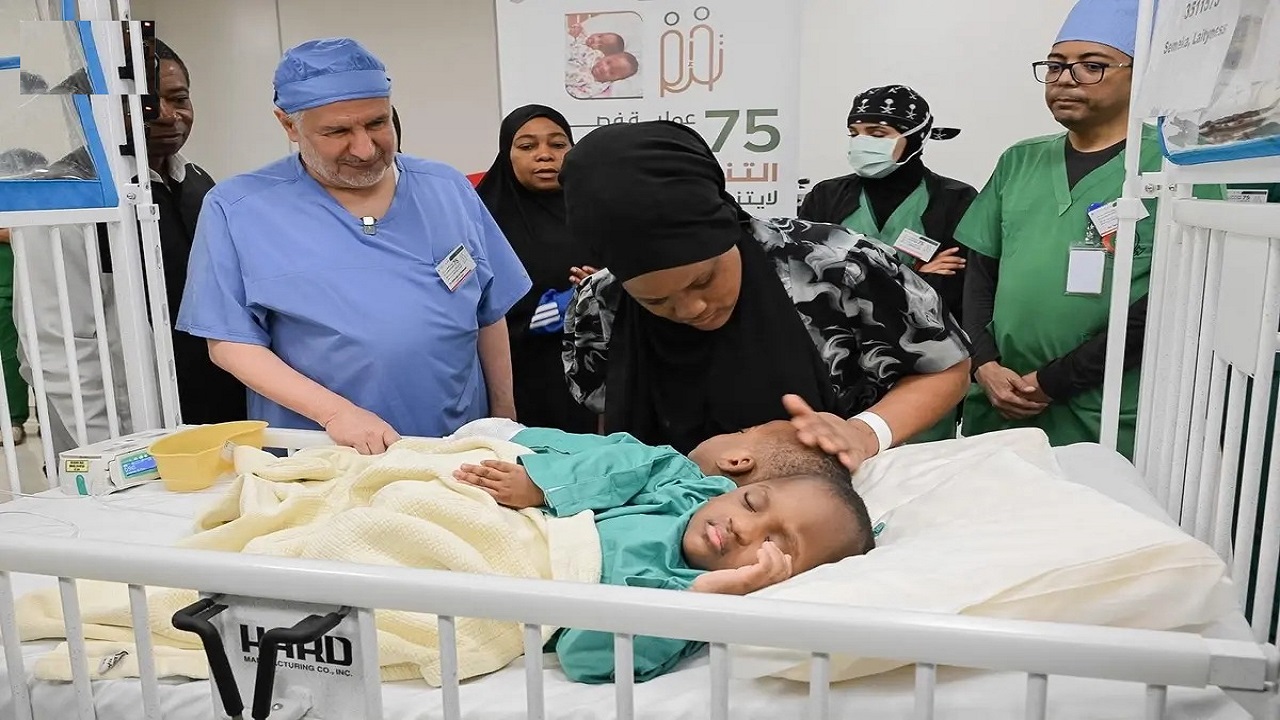 بدء عملية فصل التوأم الملتصق التنزاني “لايتيينس ولوفنس” في الرياض.. صور