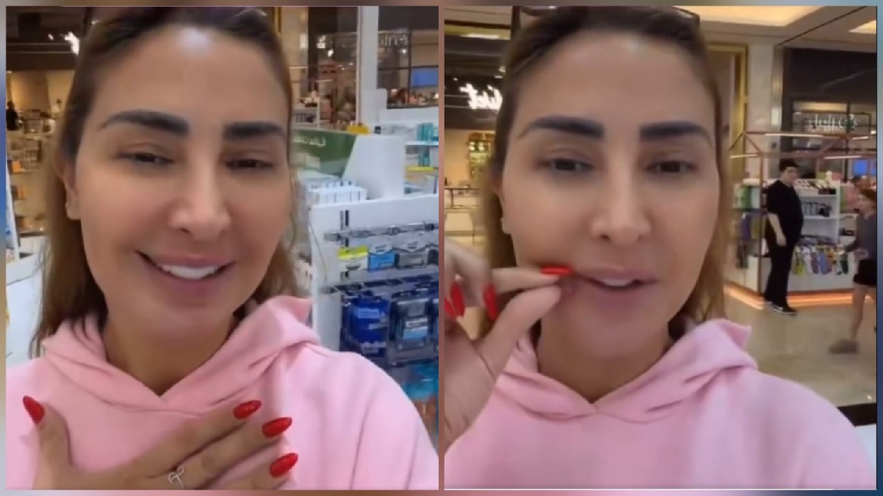 جويل مردينيان في أحدث ظهور بعد إذابة الفيلر .. فيديو