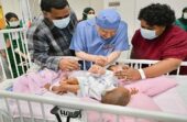 بدء عملية فصل التوأم الملتصق الفيجي “جسبيلي وديسيسيا” بالرياض
