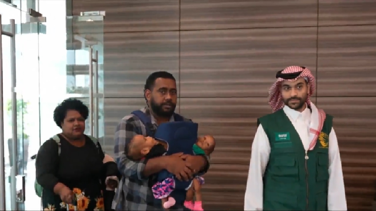 إجراء عملية فصل التوأم الفيجي دايساسيا وجيسي بيلي غدا بالرياض ..فيديو