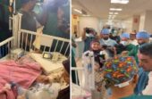 بدموع الفرح والسعادة.. والِدا ضحى وسجى يستقبلان طفلتيهما بعد نجاح عملية فصلهما.. فيديو