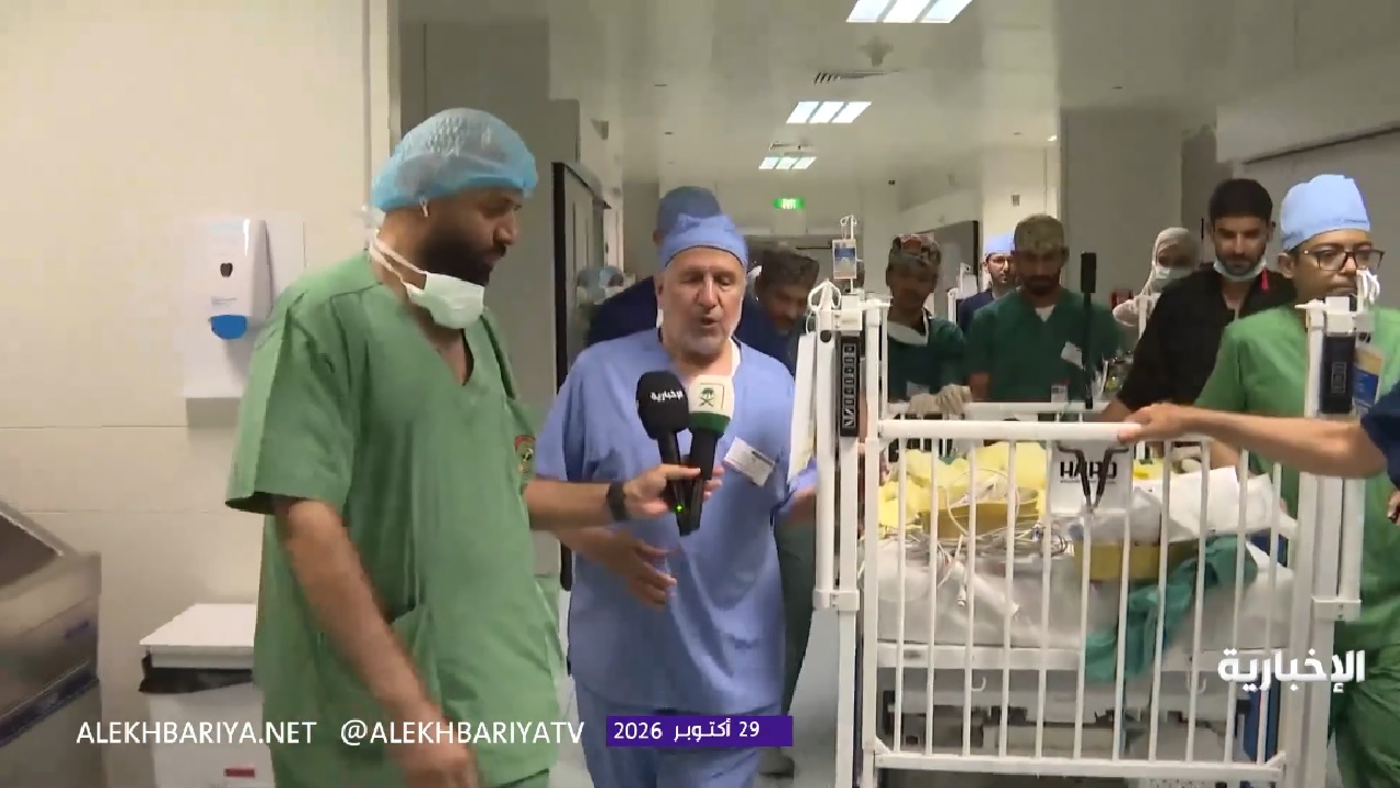 نجاح عملية فصل التوأم التنزاني بعد 14 ساعة ونصف.. فيديو