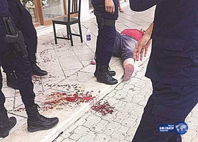 كويتي يصيب مصريًا بطلق ناري في الرأس