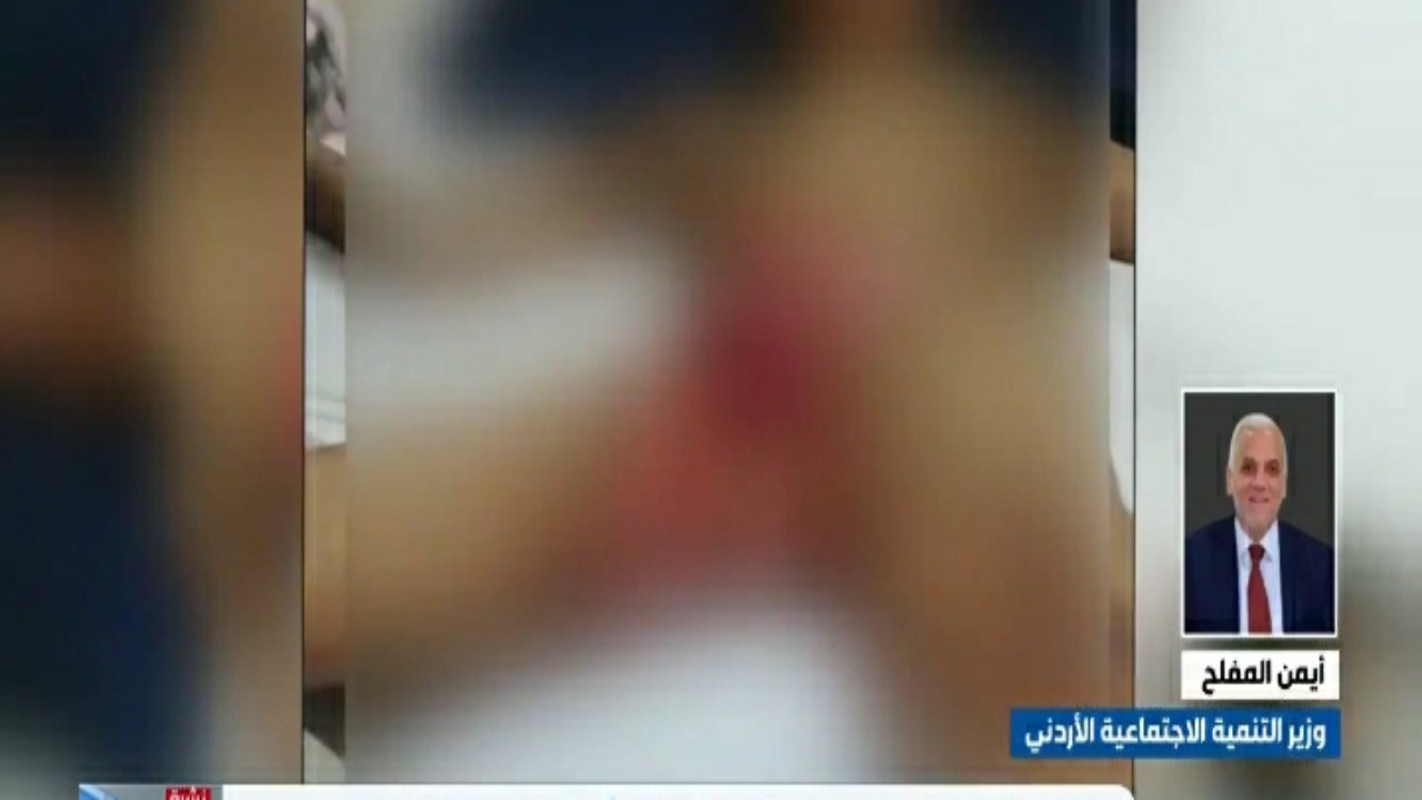 بالفيديو.. إغلاق مركز الإيواء بالأردن بعد تعرض شاب سعودي للحرق بأعضائه التناسلية داخله