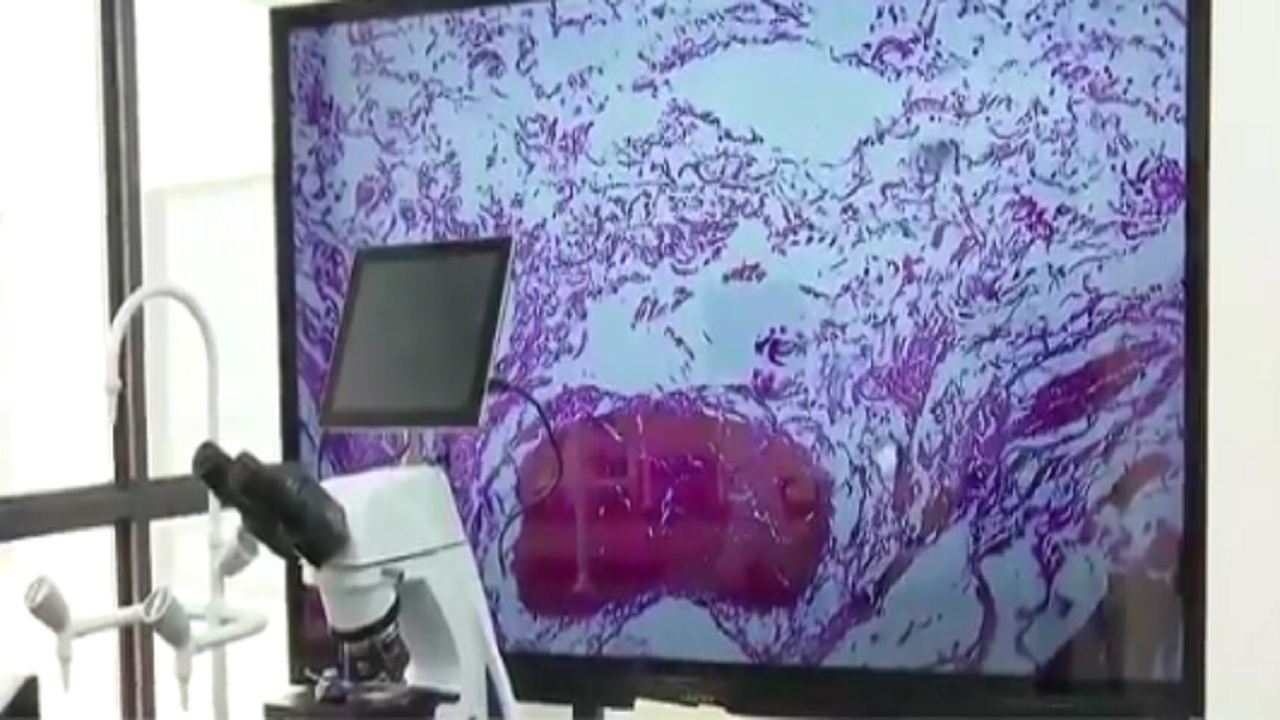 بالفيديو .. تدشين أول مركز متخصص في أبحاث السرطان ومكافحة الأوبئة في جدة