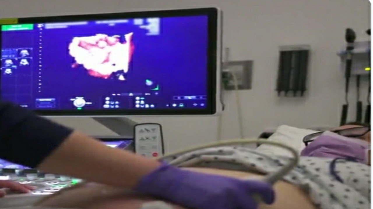 بالفيديو.. طبيب سعودي يجري جراحة دقيقة لجنين داخل رحم والدته