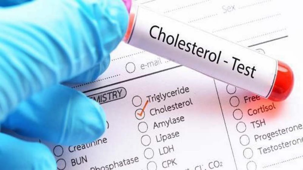 “النمر”: دواء خفض الكلسترول لا يجعله مرضًا مزمنًا