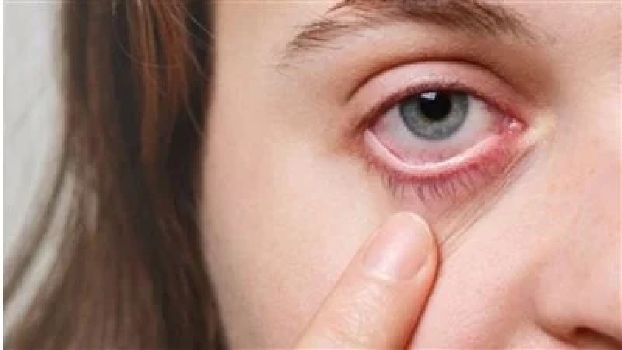 مشروب شائع يسبب إتلاف شبكية العين!