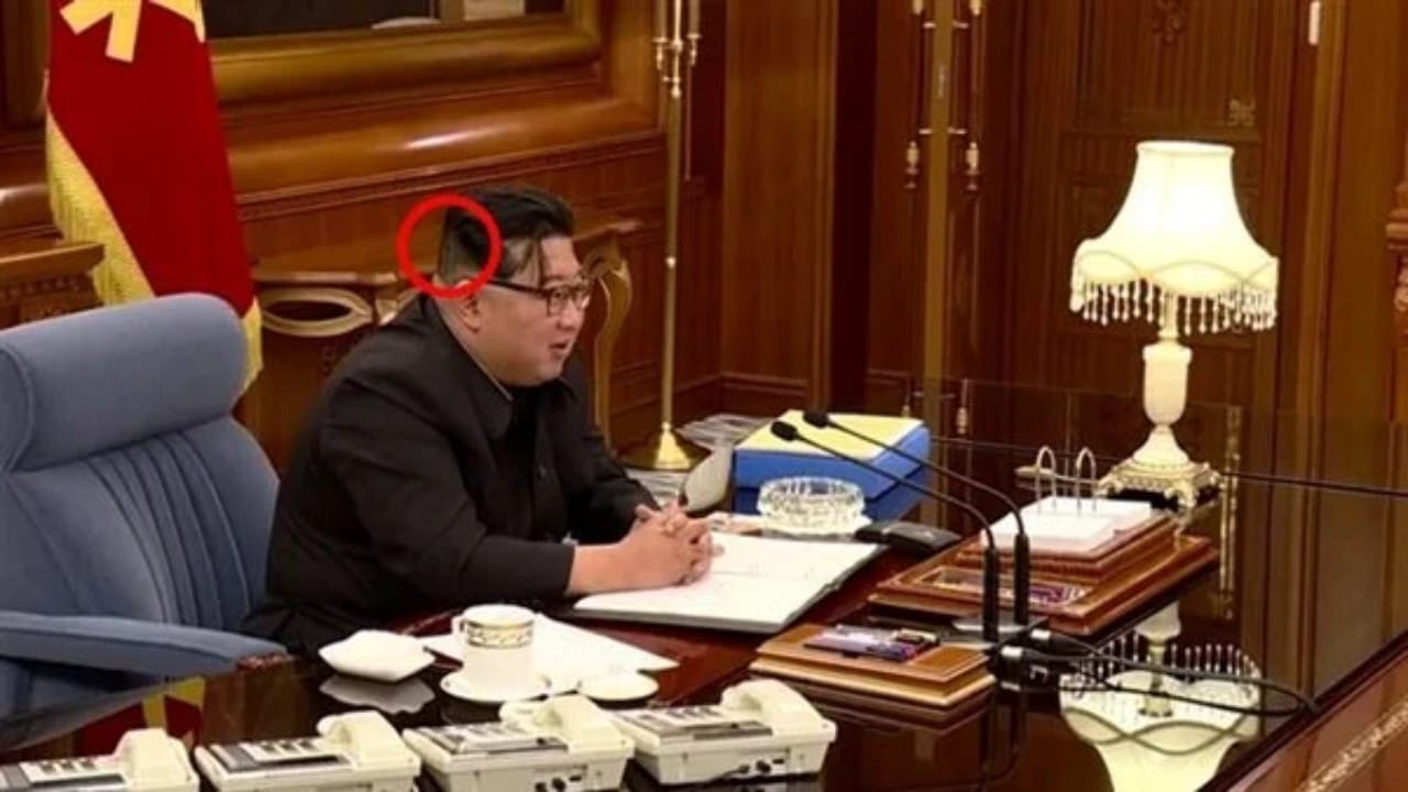 شاهد.. علامات غامضة في رقبة زعيم كوريا الشمالية تثير القلق حول صحته