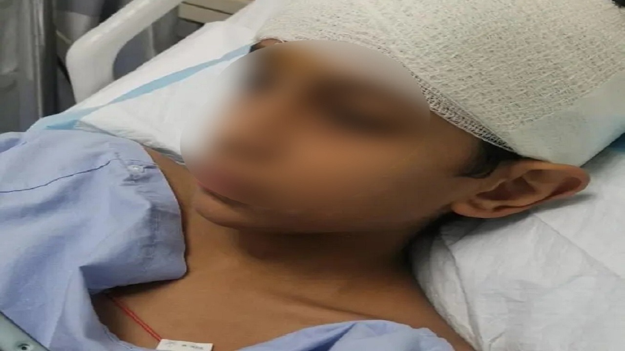 والدة الطالب المصاب بكسر الجمجمة: المعتدي متأثر بالألعاب الإلكترونية