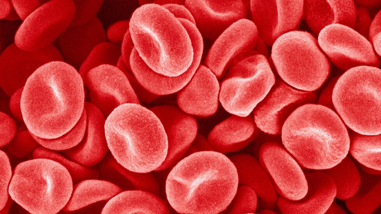 &#8220;دراسة&#8221; توضح فصيلة الدم التي تتنبأ بفيروس يصيب الأطفال