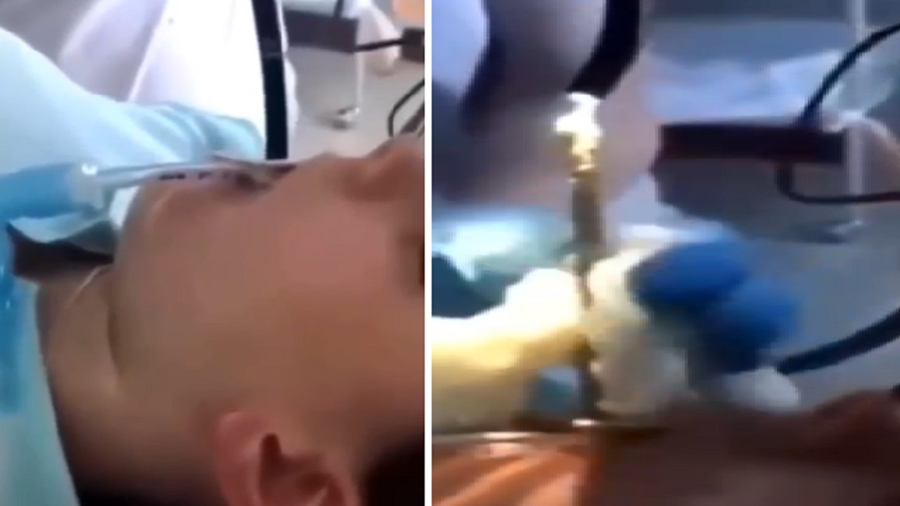 بالفيديو .. أطباء يسحبون ثعبانًا حيًا من فم امرأة