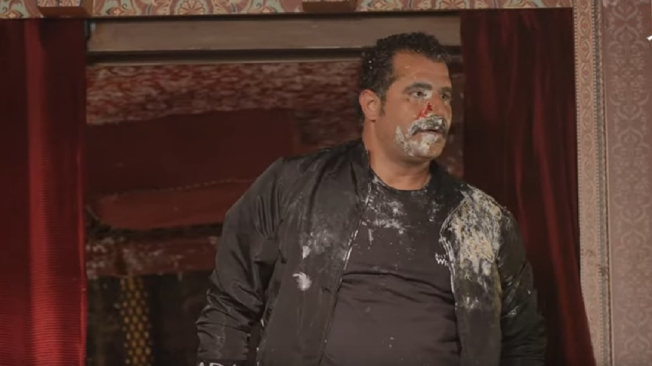 شاهد.. فنان مصري يتعرض لإصابة في مقلب رامز جلال